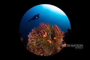 Diver with anemone by Beth Watson 
